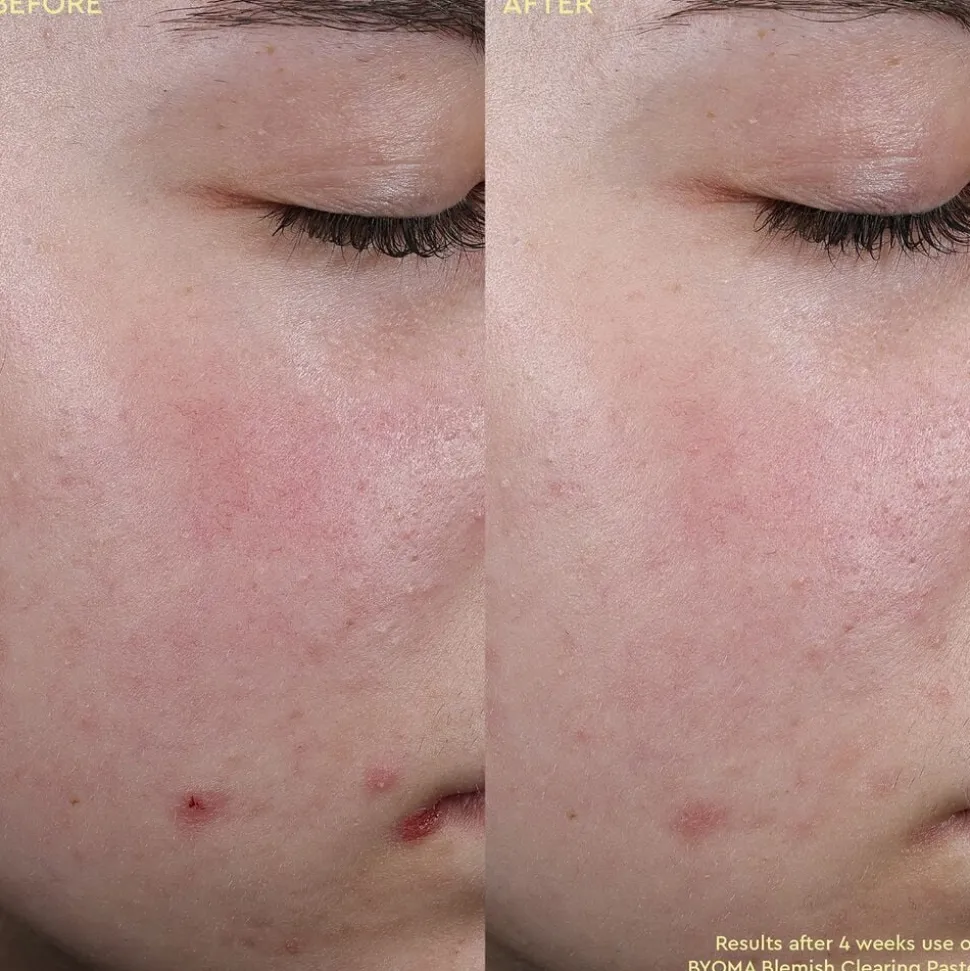 Blemish Clearing Paste - Anti-imperfektionspasta