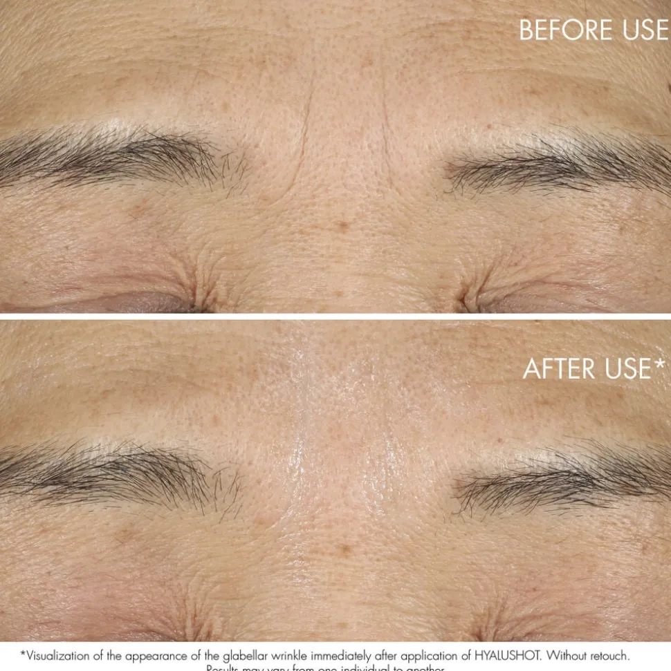 Capture Totale Retishot Retinol Night Concentrate