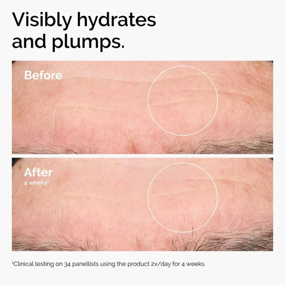 Hyaluronic Acid 2% + B5
