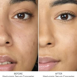 Hyaluronic Serum Concealer