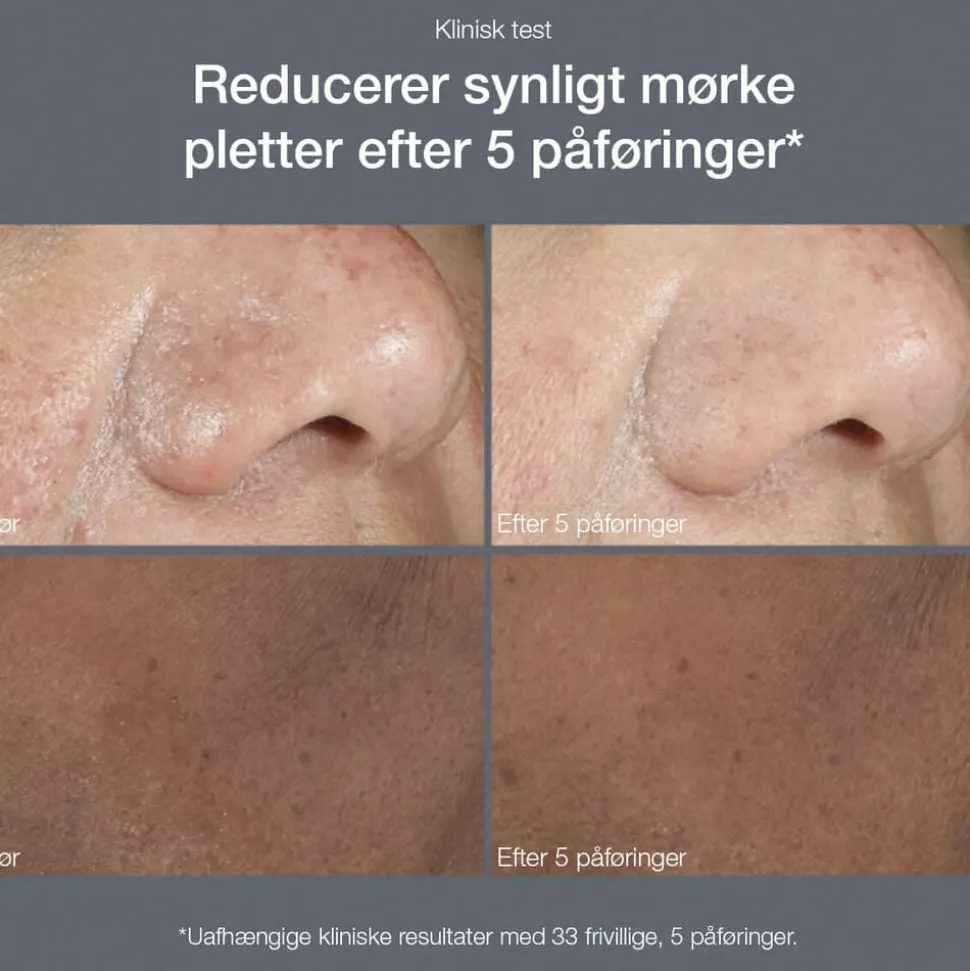 Powerbright Dark Spot Peel 50ml