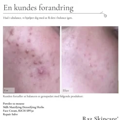 Raz Skincare Powder to Mousse 50 g