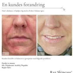 Raz Skincare Powder to Mousse 50 g