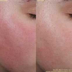 Redness Relief Soothing Toner - Beroligende toner mod rødme