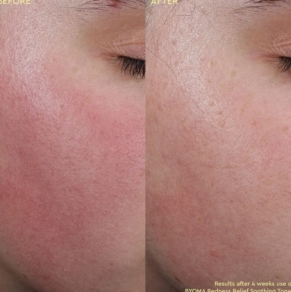 Redness Relief Soothing Toner - Beroligende toner mod rødme