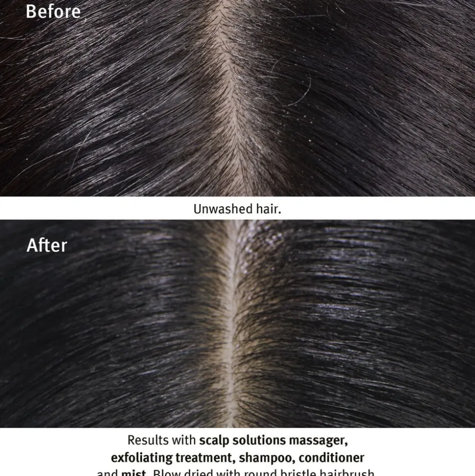 Scalp Solutions Stimulating Scalp Massager