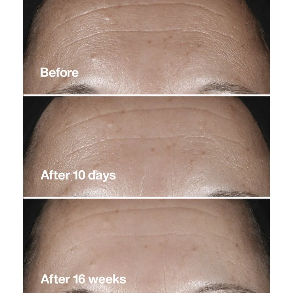 Smart Clinical Repair Wrinkle Correcting Serum