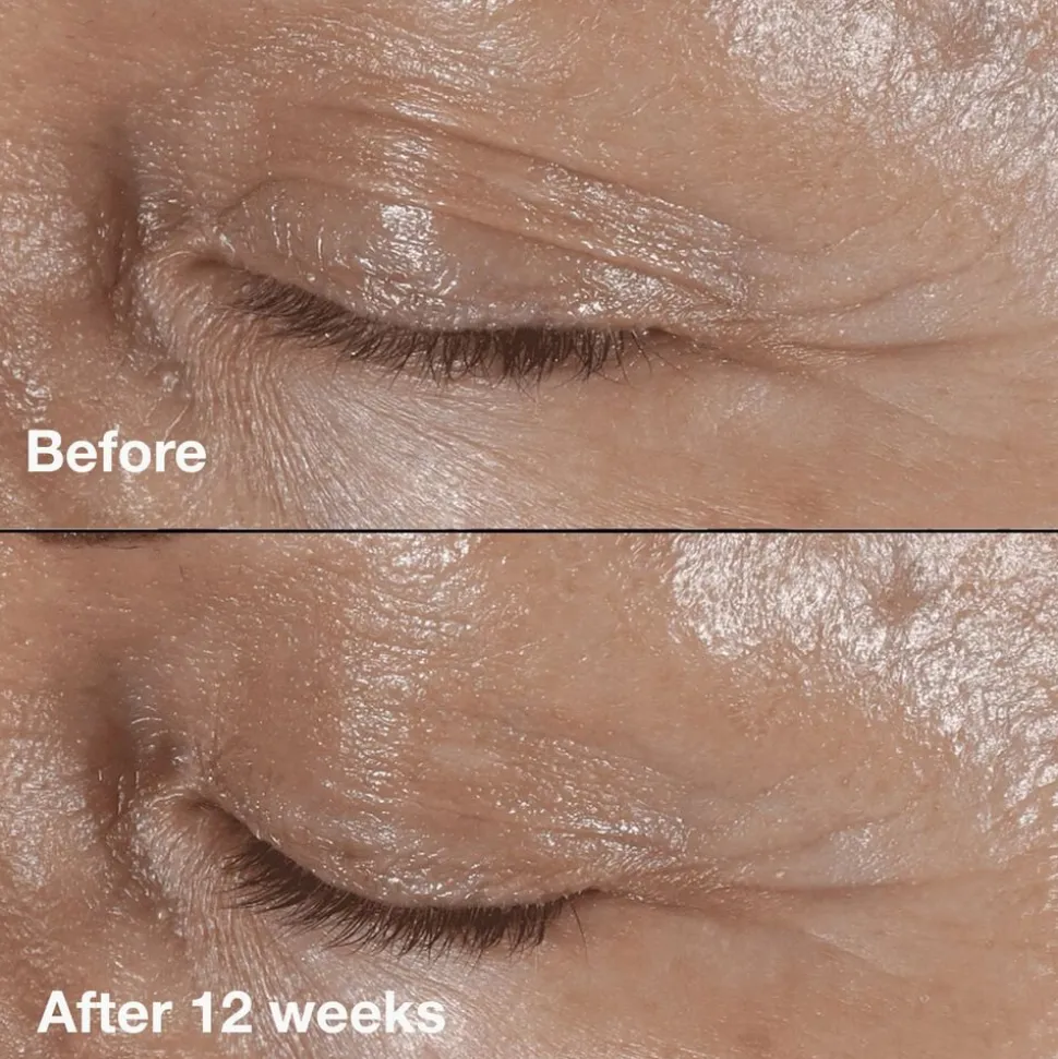 Smart Clinicial Repair Wrinkle Correcting Eye Cream