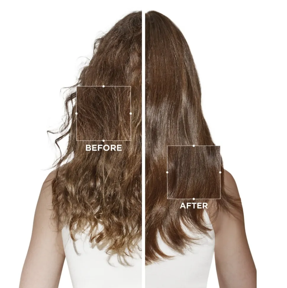 Symbiose Micropeel Treatment