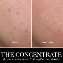 The Concentrate Face Serum