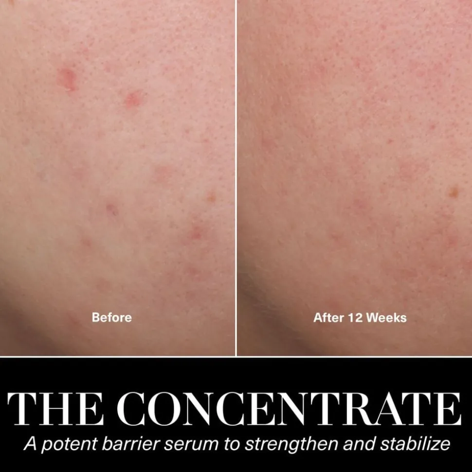 The Concentrate Face Serum