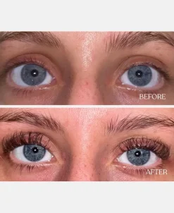 Vippeserum
